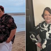 Alison Skinner before and after her weight loss journey